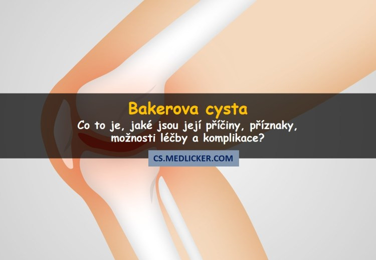 Co je Bakerova cysta, jaké jsou její příčiny, příznaky a možnosti léčby?