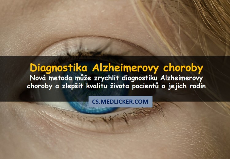 Oční vyšetření dokáže během několika sekund diagnostikovat Alzheimerovu chorobu
