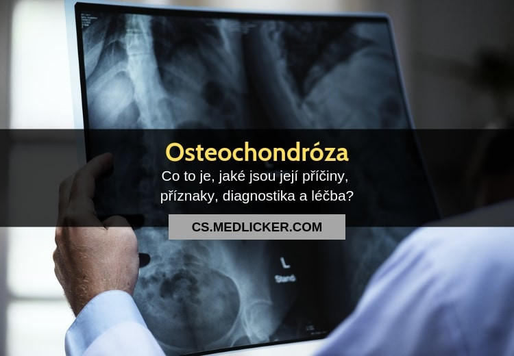 Osteochondróza a její léčba