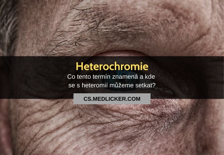Co je heterochromie? Vše co potřebujete vědět!
