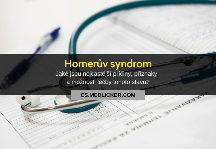 Hornerův syndrom: vše co potřebujete vědět?