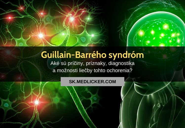 Guillain-Barrého syndróm (GBS): všetko čo potrebujete vedieť!