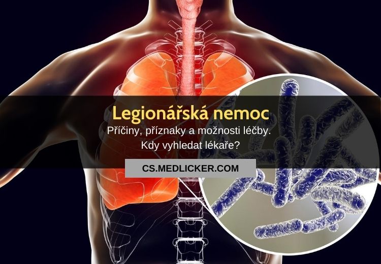 Legionářská nemoc (legionelóza): vše co potřebujete vědět