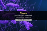 Cholera: vše co potřebujete vědět