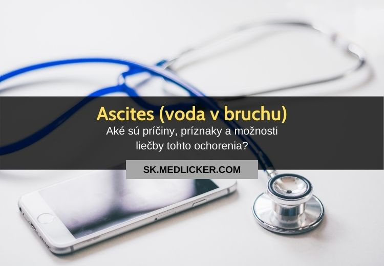 Ascites (voda v bruchu): všetko čo potrebujete vedieť