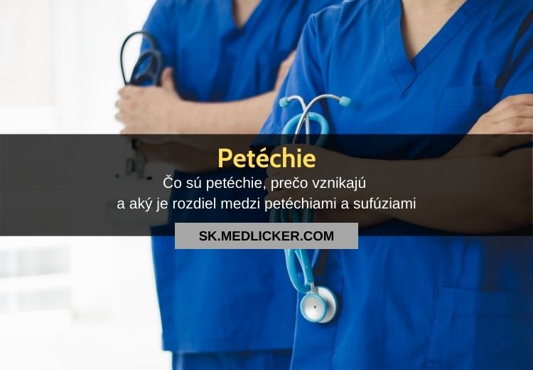 Petéchie: všetko čo potrebujete vedieť