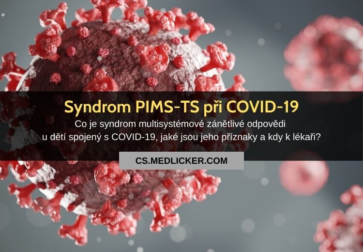 Syndrom multisystémové zánětlivé odpovědi u dětí spojený s COVID-19 (PIMS-TS, MIS-C): vše co potřebujete vědět