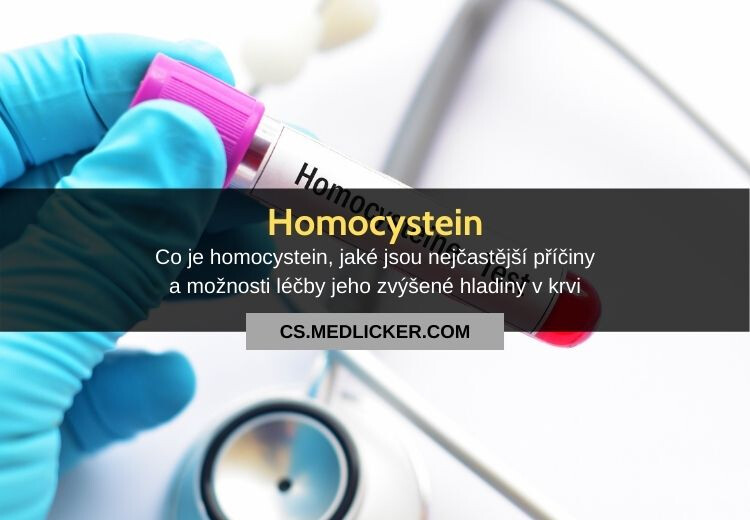 Co je homocystein, co znamená jeho zvýšená hladina v krvi a jaké jsou možnosti léčby?