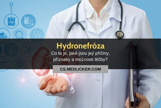 Hydronefróza: vše co potřebujete vědět