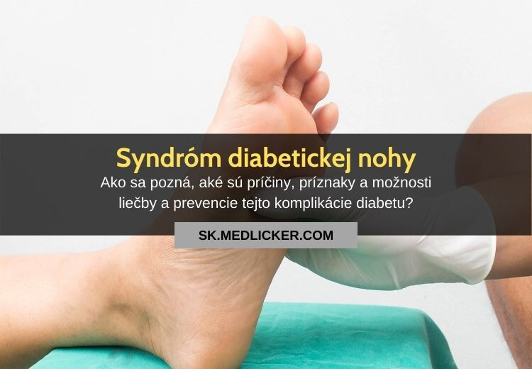 Syndróm diabetickej nohy: všetko čo potrebujete vedieť