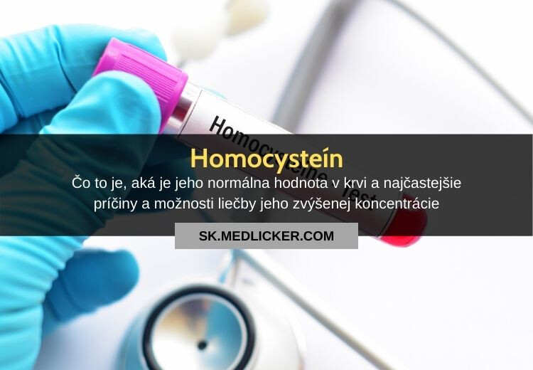 Homocysteín: hodnoty v krvi, príčiny a liečba hyperhomocysteinémie