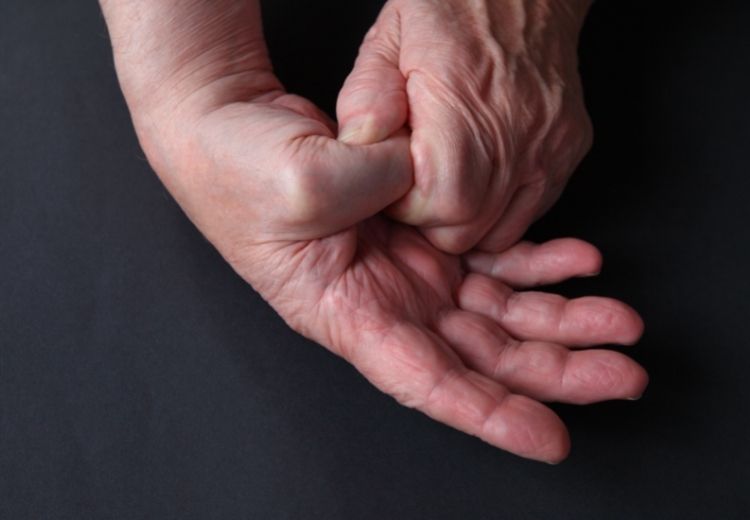 Rehabilitace je nedílnou součástí léčby bolesti palce u ruky