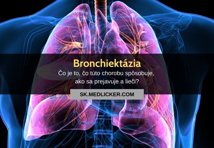 Čo je bronchiektázia, aké sú jej príznaky a možnosti liečby?