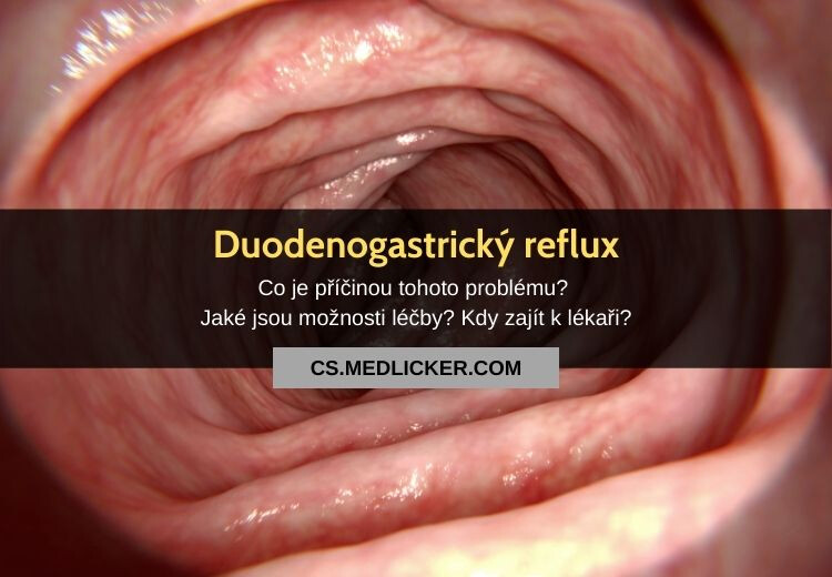 Vše co potřebujete vědět o duodenogastrickém refluxu