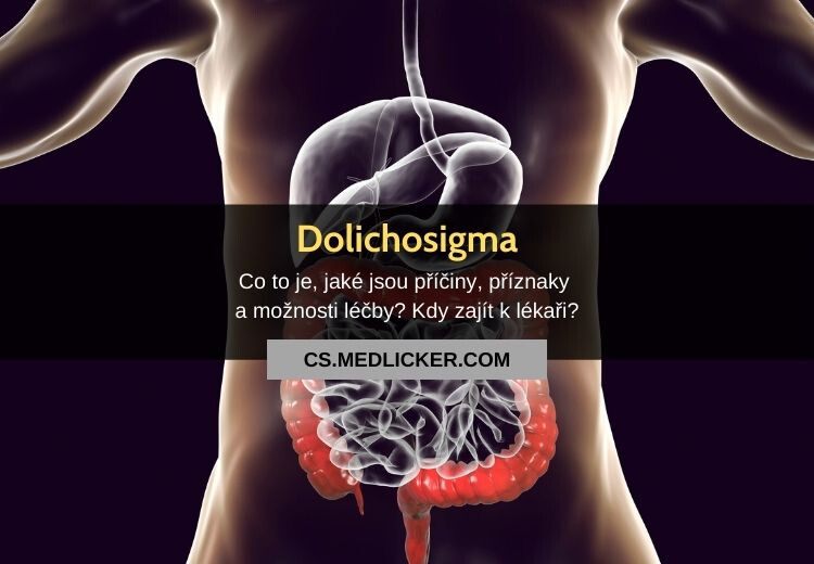 Dolichosigma (dolichosigmoideum): vše co potřebujete vědět!