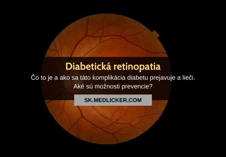 Diabetická retinopatia: všetko čo potrebujete vedieť!
