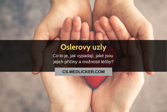 Co jsou Oslerovy uzly?