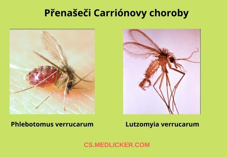 Carriónovu chorobu přenáší některé druhy pakomárů, zejména druhy Phlebotomus verrucarum a Lutzomyia verrucarum