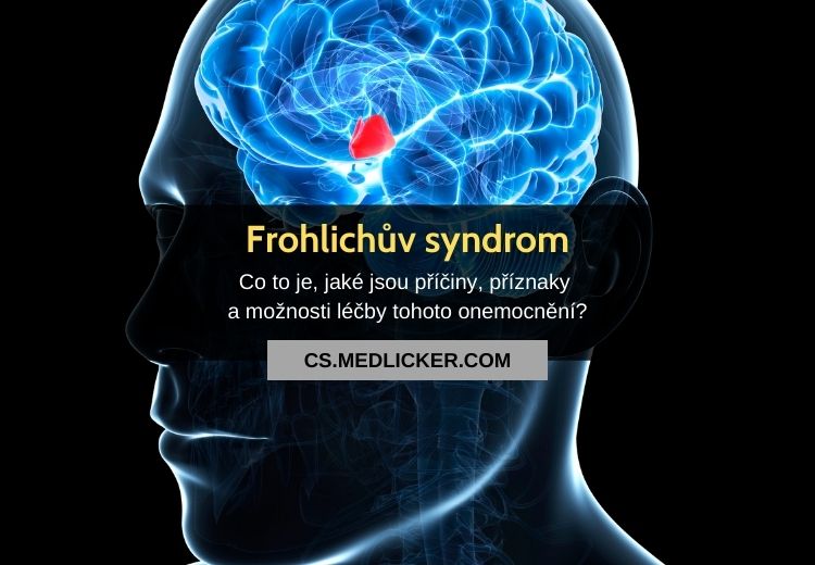 Frohlichův syndrom (adiposogenitální dystrofie): vše co potřebujete vědět