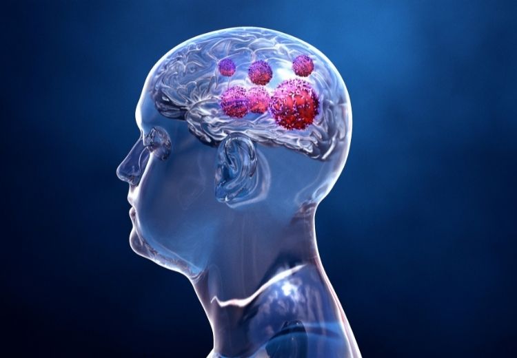 Příčinou Frohlichova syndromu jsou zejména některé nádory mozku, jako je například kraniofaryngeom nebo adenom hypofýzy