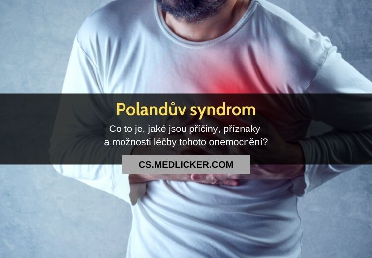 Polandův syndrom: vše co potřebujete vědět