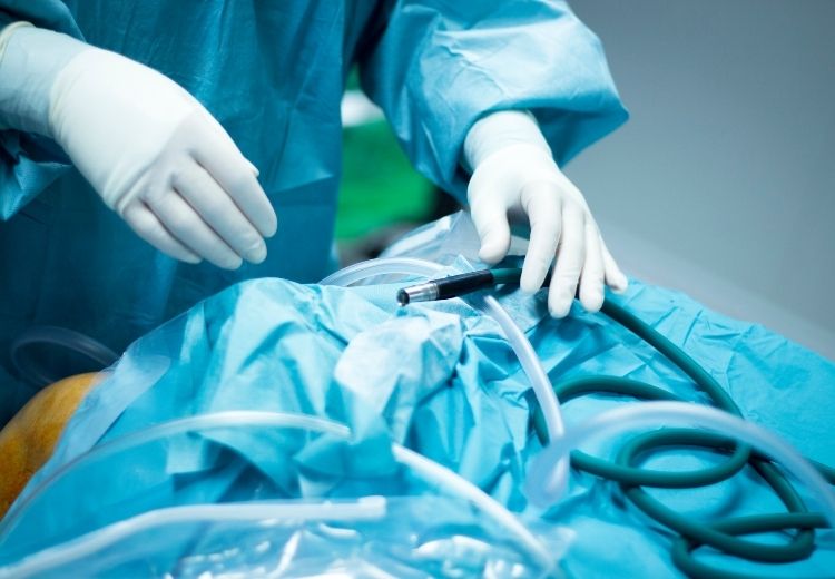 Artroskopická operácia je jednou z možností chirurgického odstránenia gangliómu