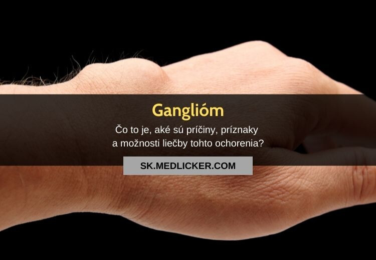 Čo je ganglióm, prečo sa vytvára a ako ho odstrániť?