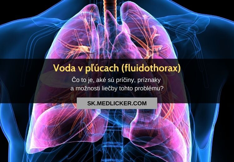 Fluidothorax (voda v pľúcach, pleurálny výpotok): všetko, čo potrebujete vedieť