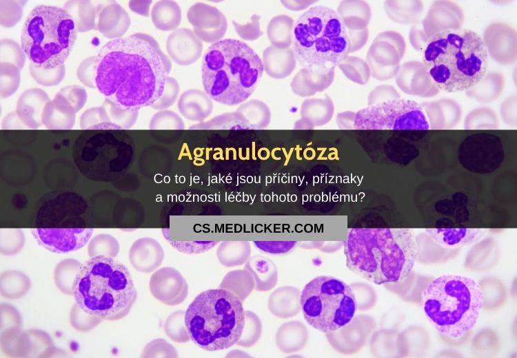 Agranulocytóza (granulocytopenie): vše co potřebujete vědět!