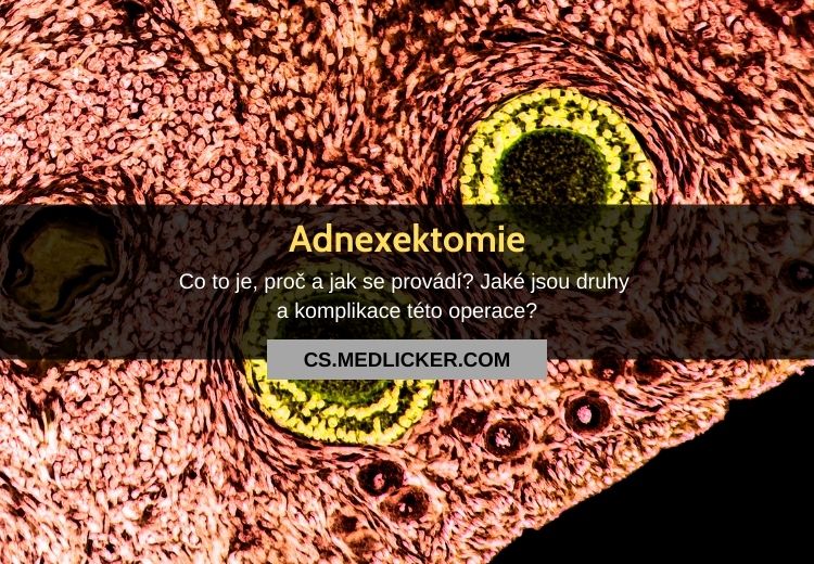Co je adnexektomie, proč a jak se provádí?