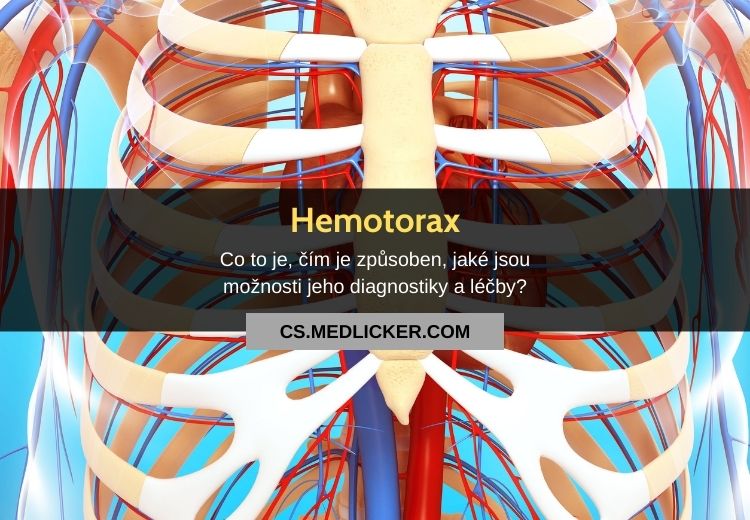 Co je to Hemothorax?