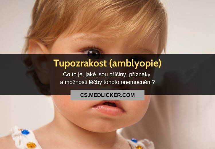 Tupozrakost (amblyopie): vše co potřebujete vědět