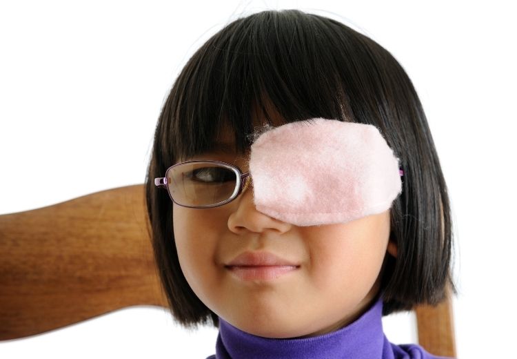 Léčba tupozrakosti (amblyopie) spočívá v posílení oslabeného oka (zakrytím zdravého oka) a také v řešení vyvolávající příčiny (například v korekci zrakových vad nebo šilhání)