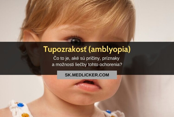 Tupozrakosť (amblyopia): všetko, čo potrebujete vedieť
