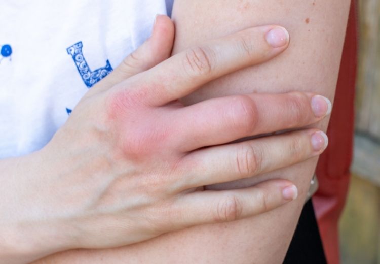 Úrazy, hmyzí bodnutí nebo infekce jsou častou příčinu oteklých prstů na rukou