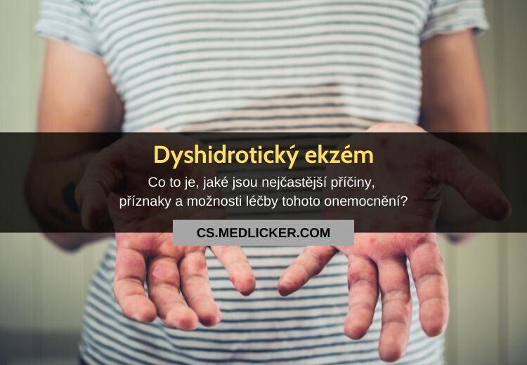 Co je dyshidrotický ekzém, jaké jsou jeho příznaky a možnosti léčby?