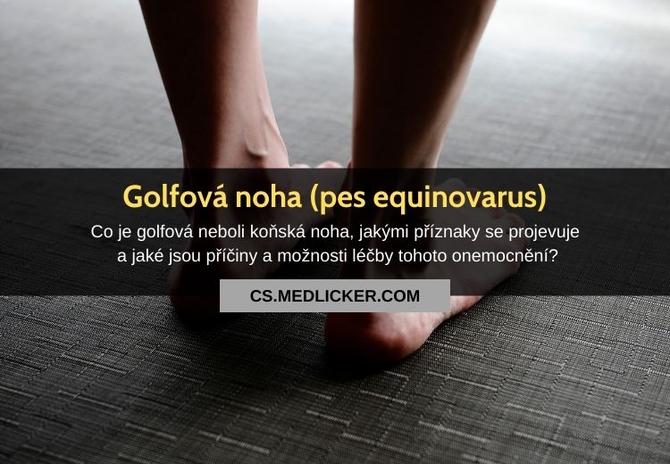 Golfová noha (pes equinovarus congenitus): vše co potřebujete vědět