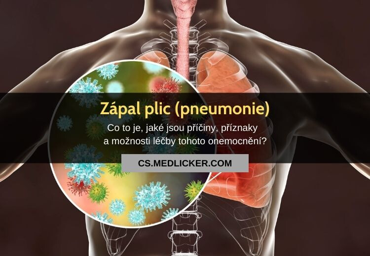Zápal plic (pneumonie): vše co potřebujete vědět!