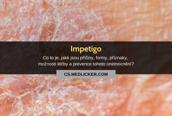 Impetigo: vše co potřebujete vědět