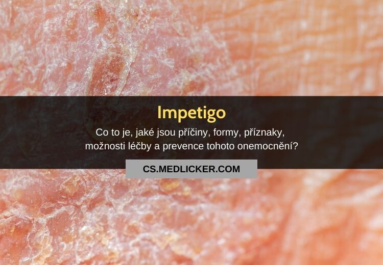 Impetigo: vše co potřebujete vědět