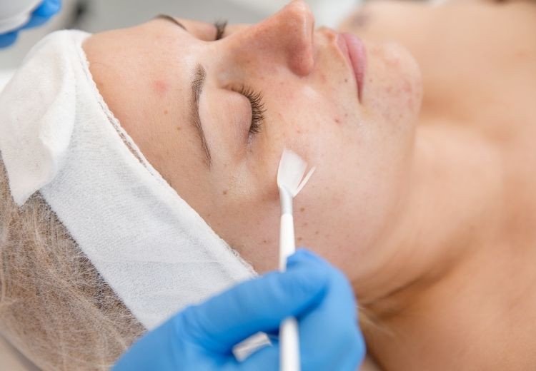 V léčbě otoků pod očima se uplatňují i kosmetické metody, jako je chemický peeling nebo laserový resurfacing