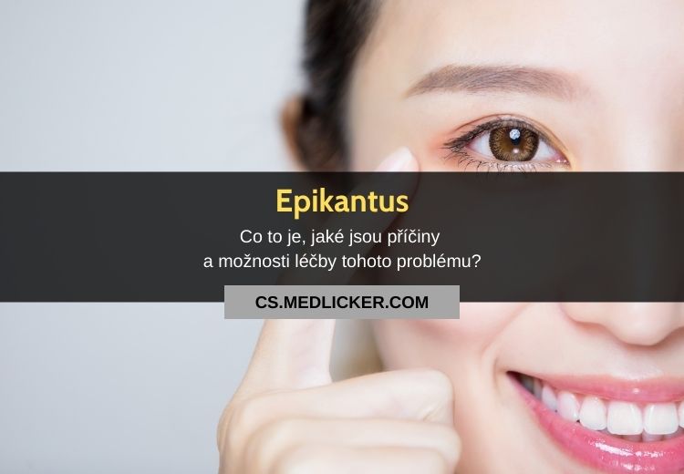 Epikantus: vše co potřebujete vědět!