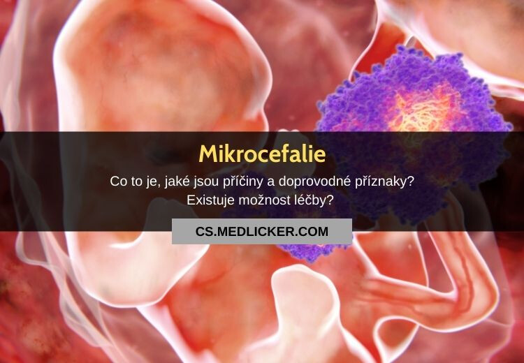 Vše co potřebujete vědět o mikrocefalii!