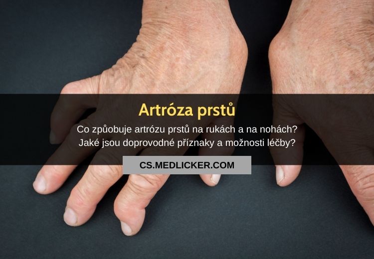 Artróza prstů na rukách a nohách: vše co potřebujete vědět!