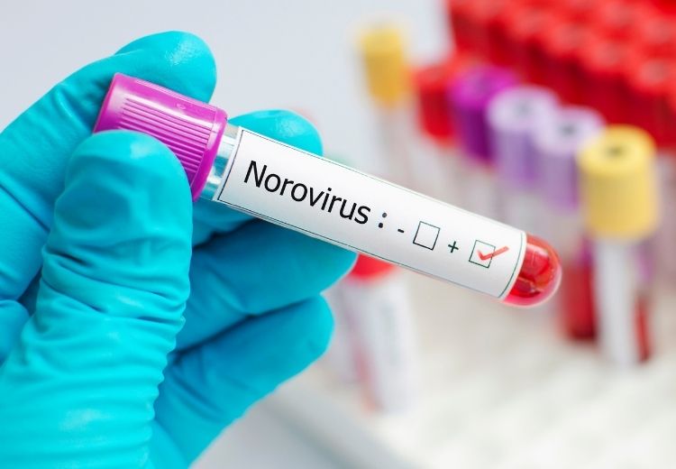 Mezi nejčastější původce střevní chřipky patří norovirus.