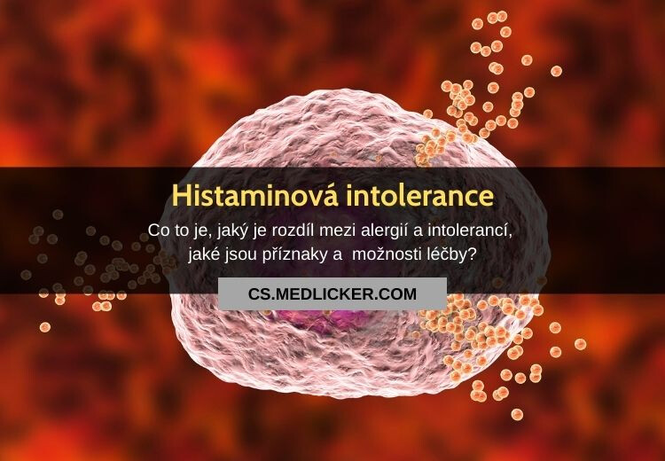 Histaminová intolerance není alergie! Co jí způsobuje a jaké jsou její příznaky?