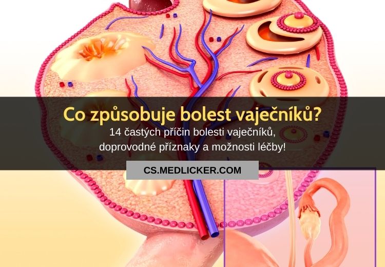 14 příčin bolesti vaječníků! Jaké jsou doprovodné příznaky a možnosti léčby?
