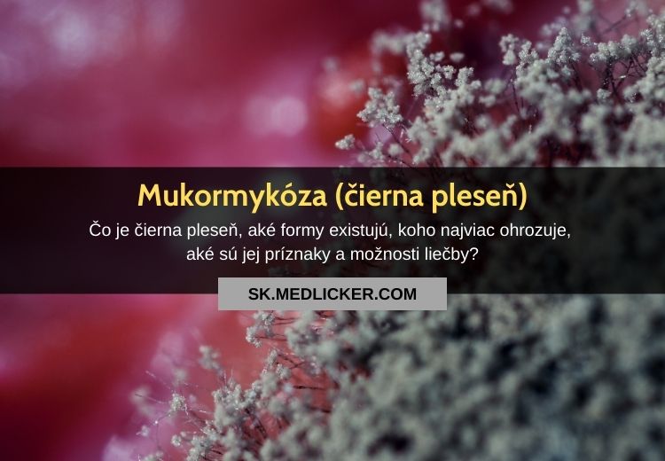 Mukormykóza (čierna pleseň): všetko, čo potrebujete vedieť