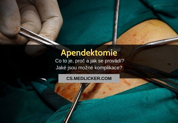 Co je apendektomie, jak a proč se provádí?