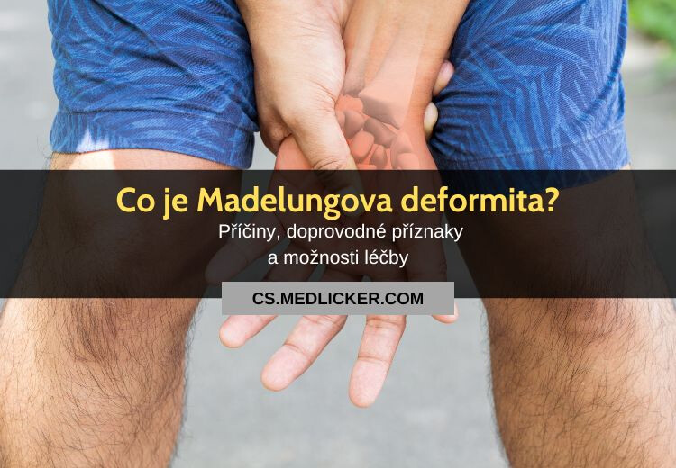 Co je Madelungova deformita?
